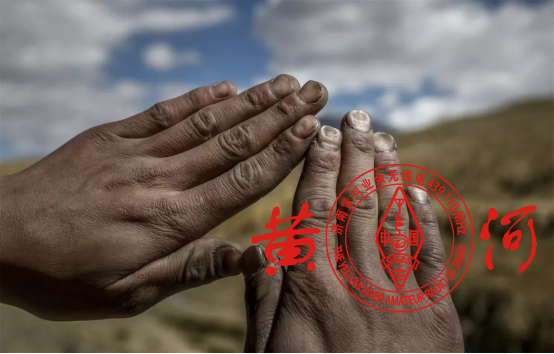 我和战友们长期吃不到蔬菜,严重缺乏维生素,所有人的指甲都会塌陷